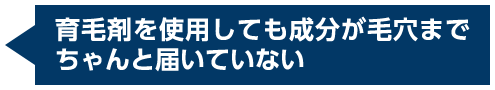 育毛剤を使用しても成分が毛穴までちゃんと届いていない