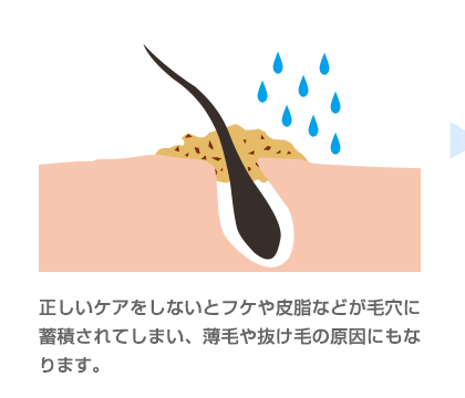 毛穴に詰った汚れの画像