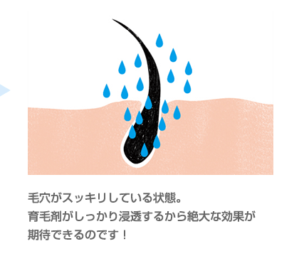 毛穴がスッキリしていて育毛剤が浸透している状態